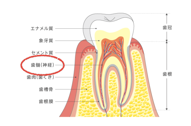根管治療（歯の神経をとる） １